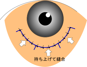 グĖD